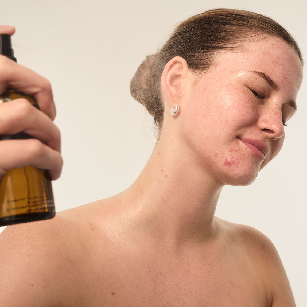 Eine Frau sprüht aus einer Braunglasflasche auf ihr Gesicht. Die Haut zeigt Unreinheiten und ist leicht glänzend.