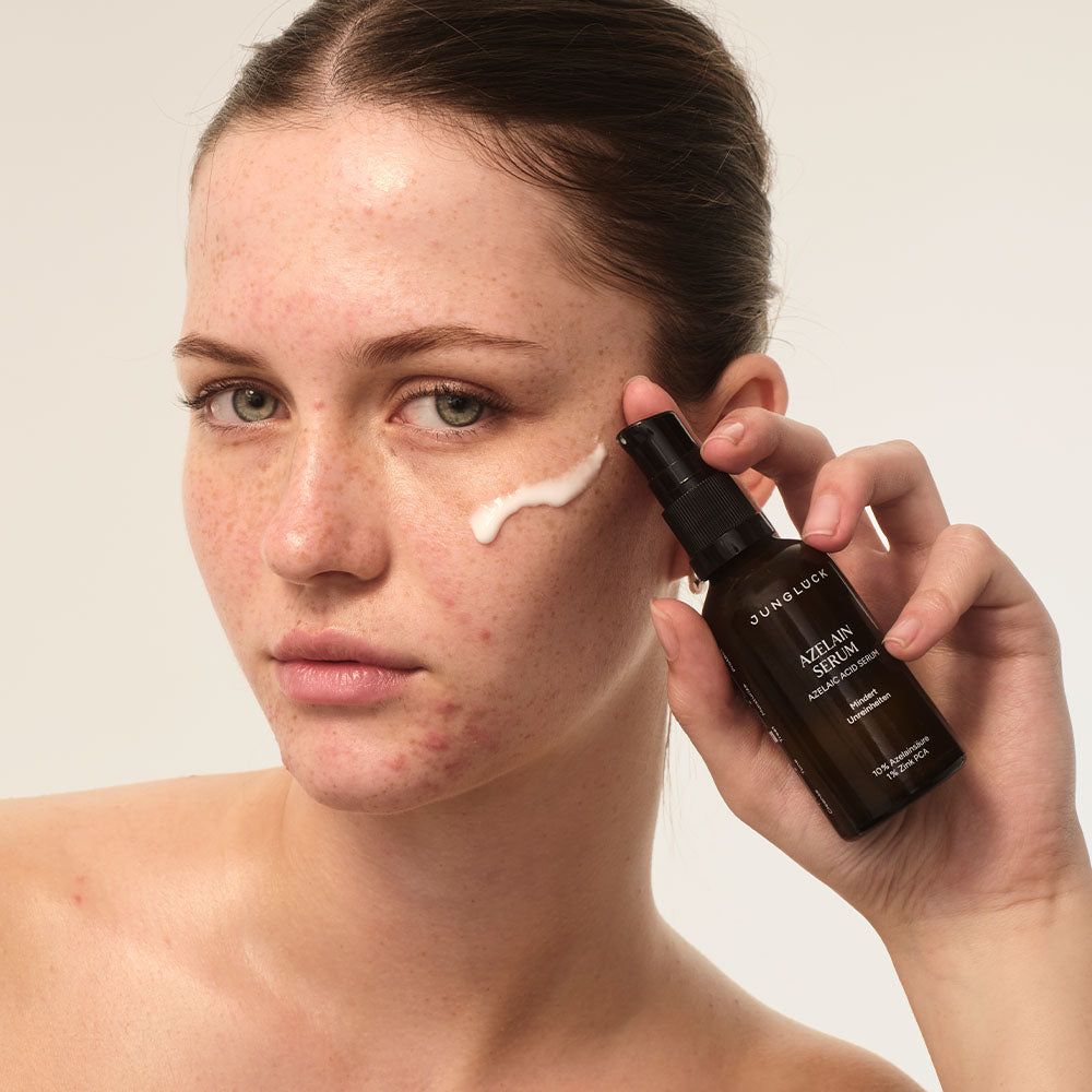 Junge Frau hält eine Braunglasflasche mit AZELAINE SERUM und trägt eine Creme auf ihr Gesicht auf.