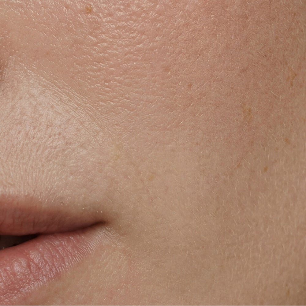 Nahaufnahme von glatter, gesund aussehender Haut mit sanften Lippen. Ideal für den pflegenden Feuchtigkeitskomplex.