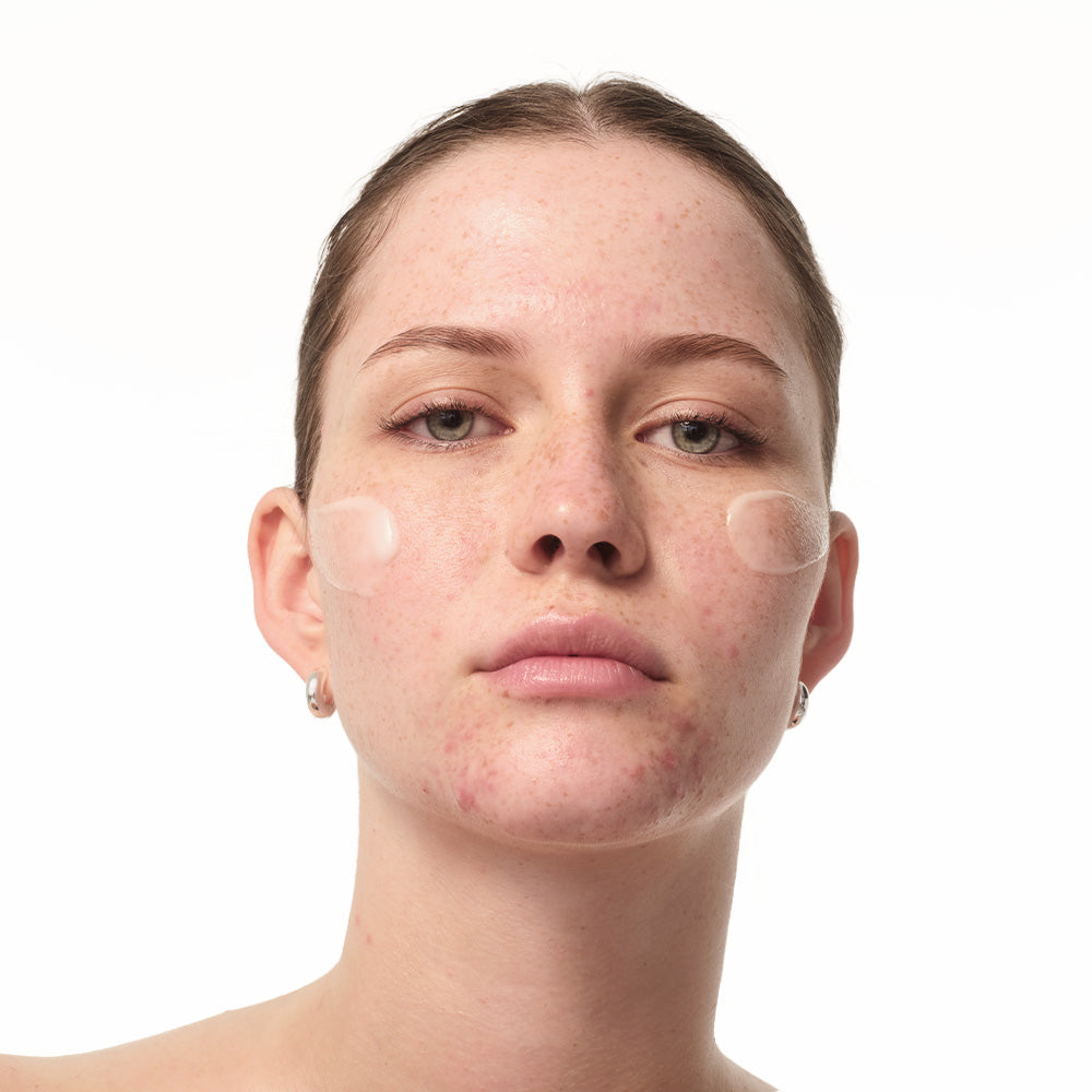Nahaufnahme eines Gesichts mit transparenten Pflegemasken auf den Wangen. Die Haut zeigt dezente Unreinheiten.